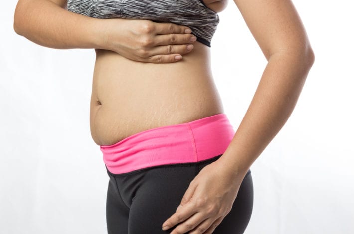 new mother belly postpartum recovery