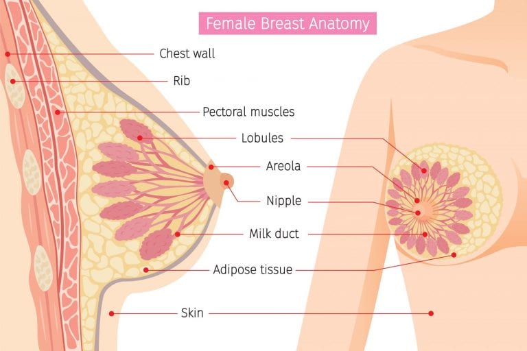 cancerul mamar stadii